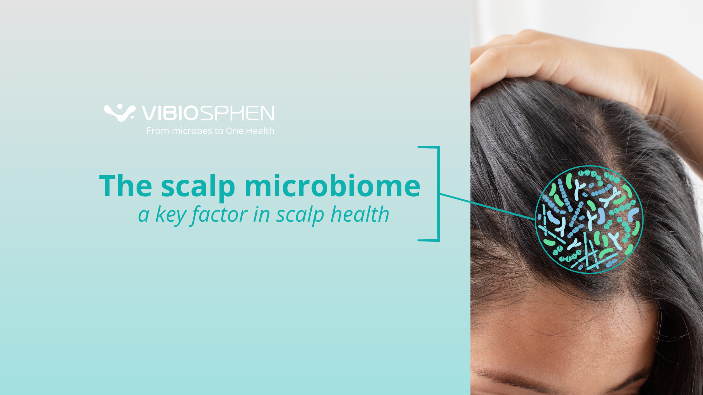The scalp microbiome a key factor in scalp health