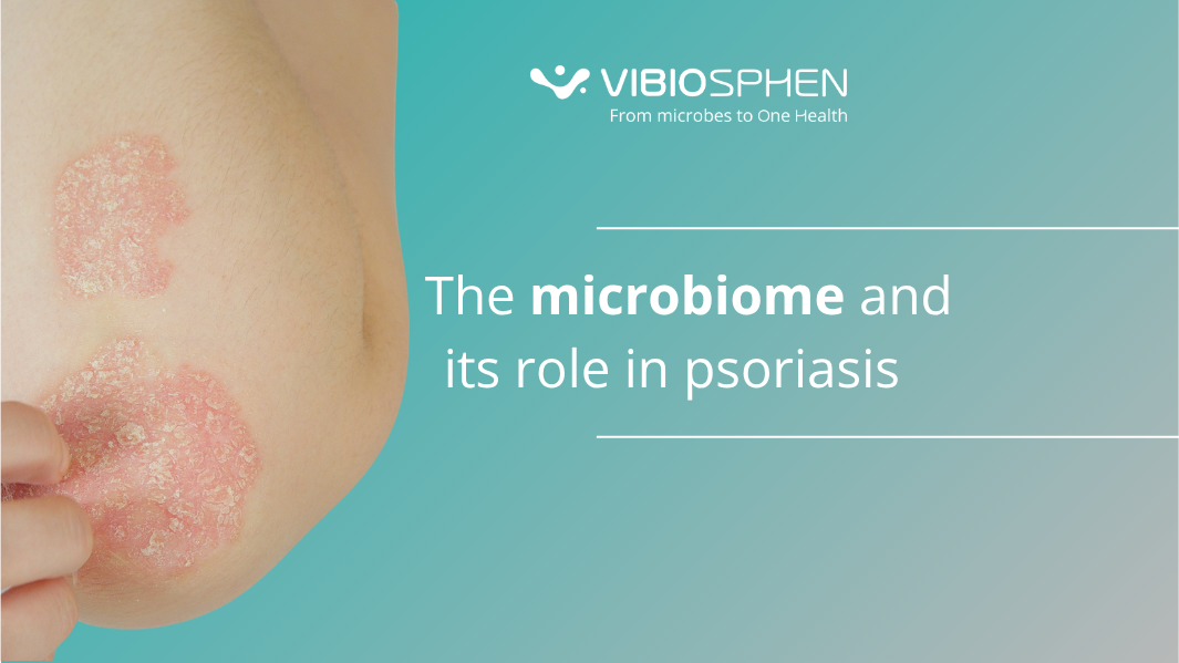 Psoriasis