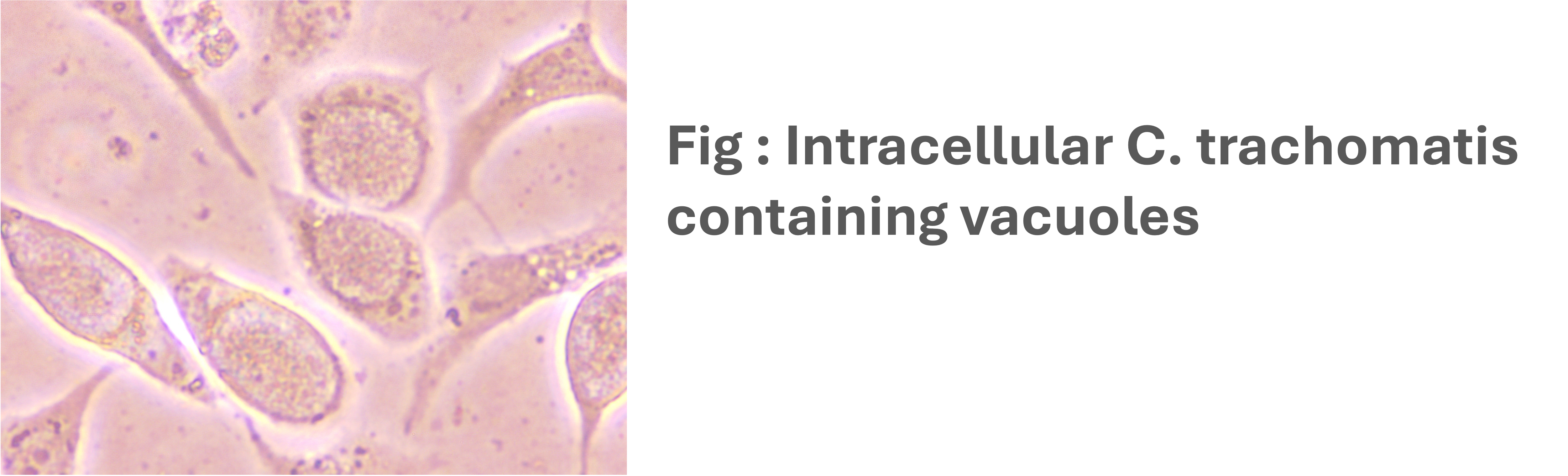 Intracellular C. trachomatis-containing-vacuoles