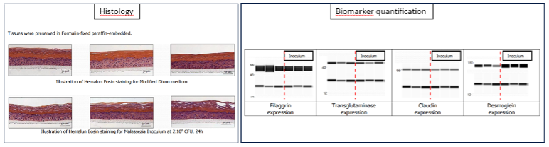 Histology and biomarker