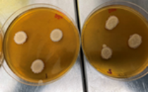 Model of in vitro human scalp microbiota