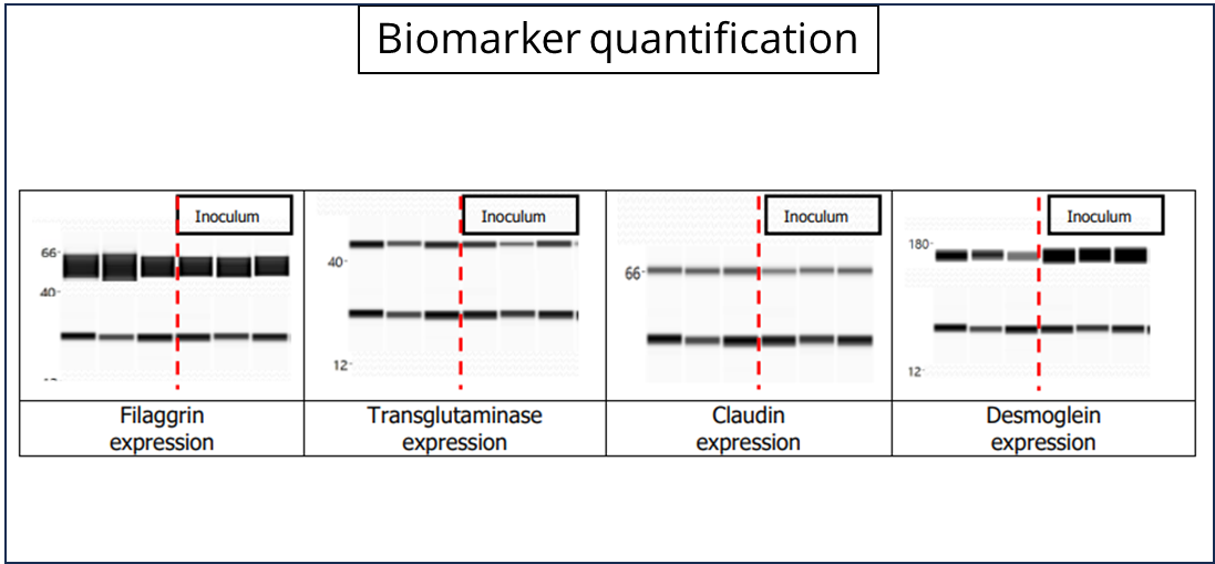 Reconstructed Human Epidermis (RHE)