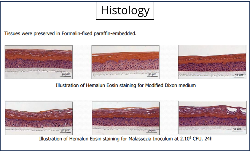 Reconstructed Human Epidermis (RHE)