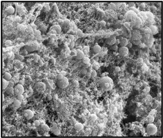 Background of in vitro-biofilm