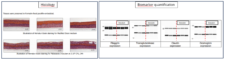scalp histology and biomarker
