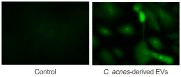 Fig. Filaggrin expression of keratinocytes  exposed to EVs from C. acnes