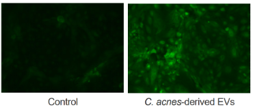 Fig. Lipid production induced by C. acnes-derived EVs in sebocytes (Bodipy staining)